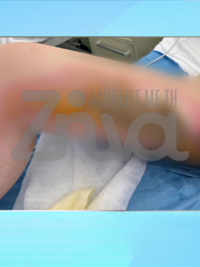 stargr_zina_20xronh_egaumata_transfer
