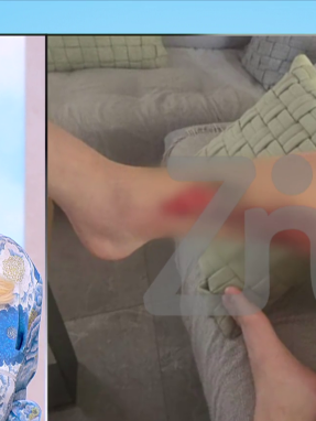 stargr_zina_traumatismos_astynomikou_kykloma_transfer