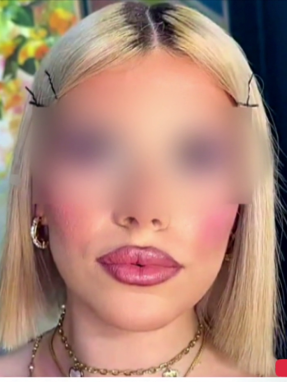 stargr_zina_xenodoxos_transfer